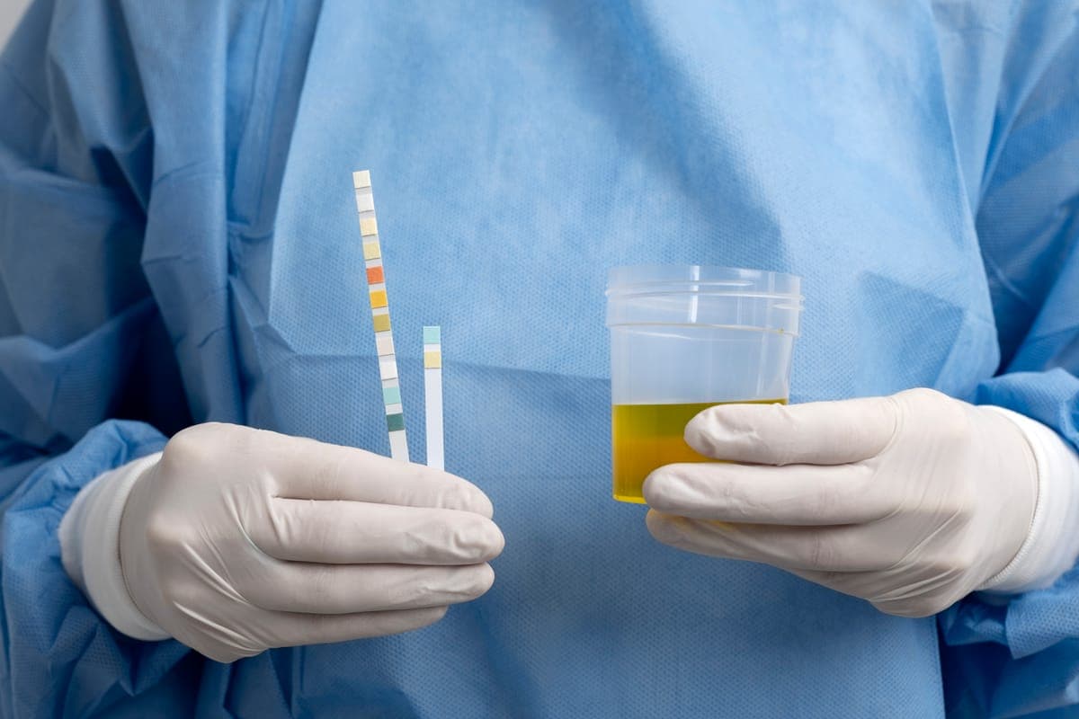 Stool Testing