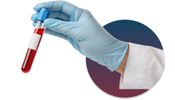 Hand holding medical test sample